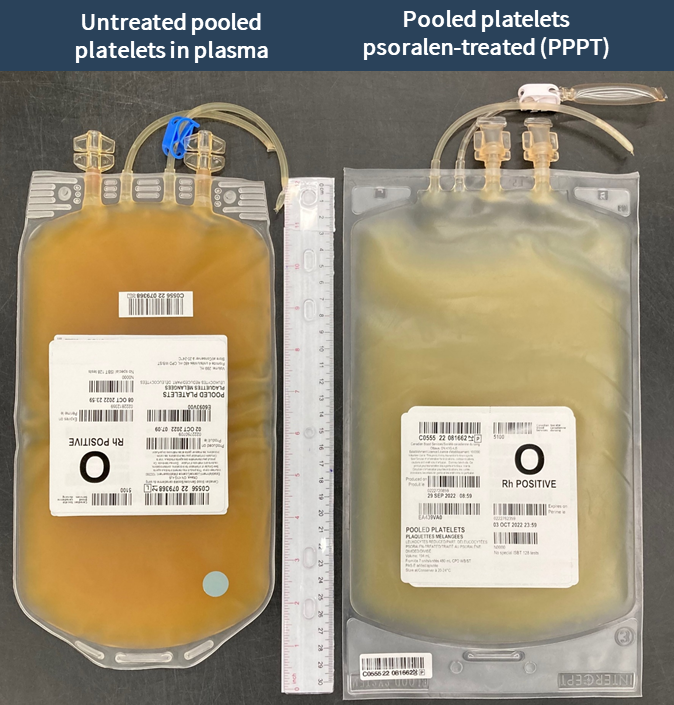 Pathogenreduced platelets Professional Education
